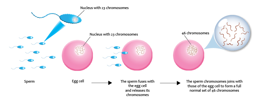 This is a pedagogical portrayal of fertilization as a gendered process. The sperm and the nucleus (to the extreme left) are colored blue while the egg cells (3 of them), depicting insemination are pink in color. On the far right is a white circle magnifying the chromosomes within one of the egg’s nucleus.
