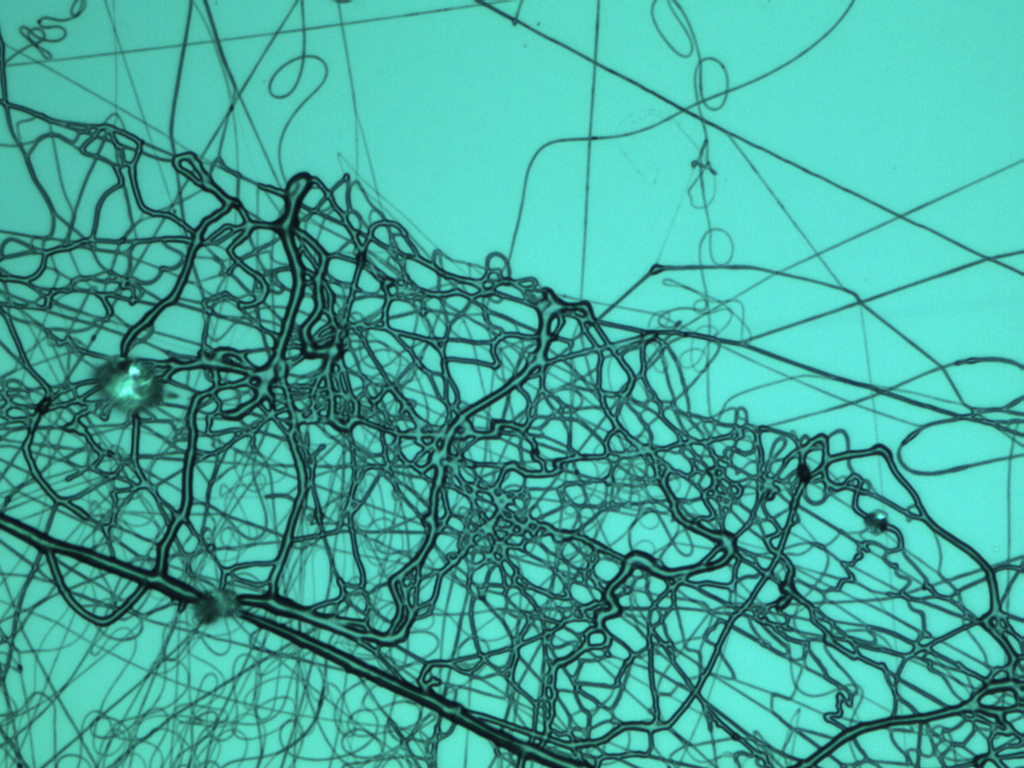 Green background with string like fibers shown in black, as if in a tangle.