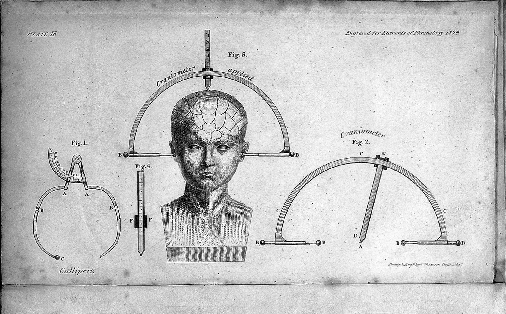 George Combe's depiction of several phrenological measuring devices, including calipers and a craniometer attached to a head.