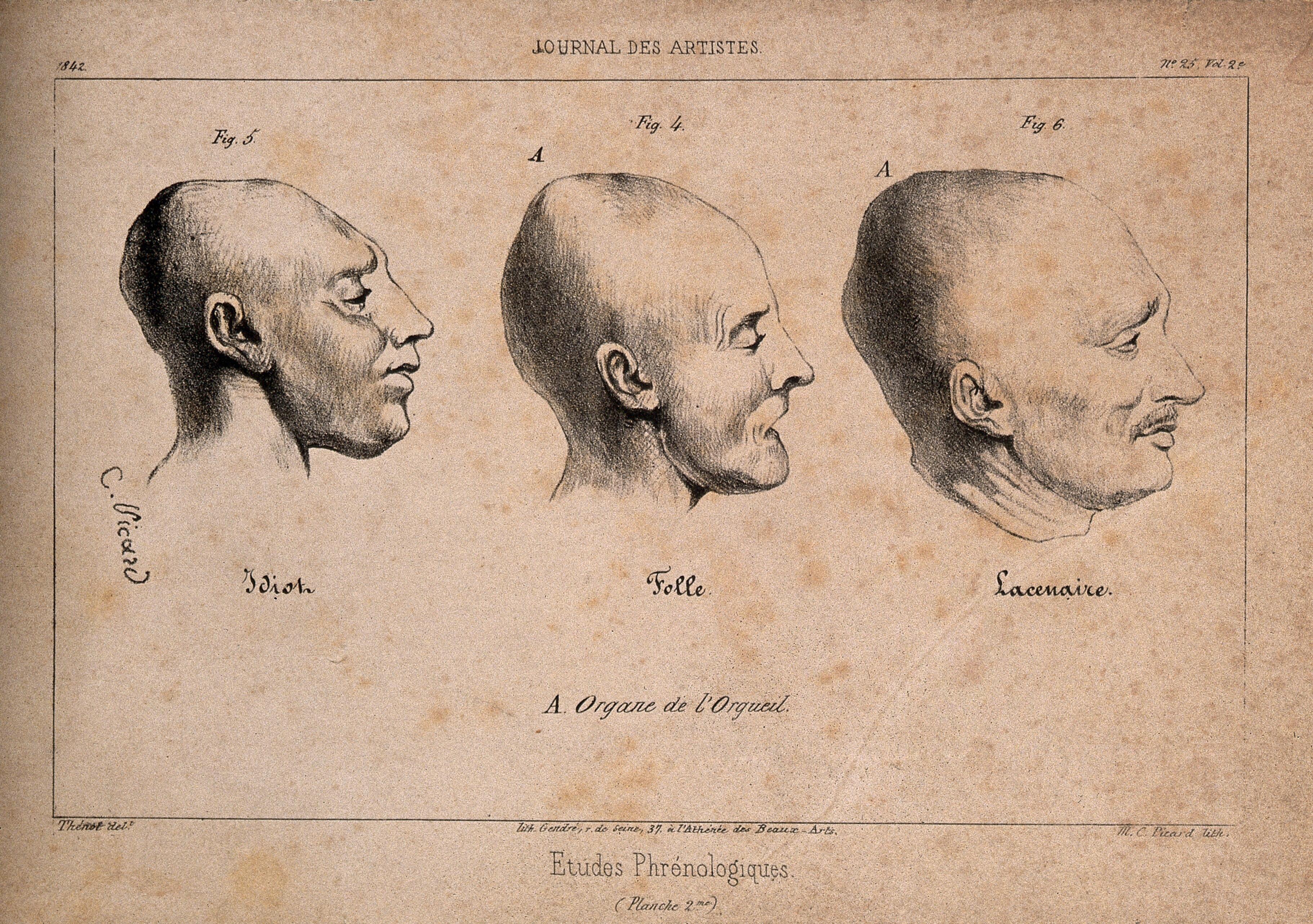 Three heads showing phrenological traits associated with insanity: a mentally defective person, a mad woman, and the murderer P.F. Lacenaire. Lithograph by C. Picard, 1842, after J.P. Thenot.